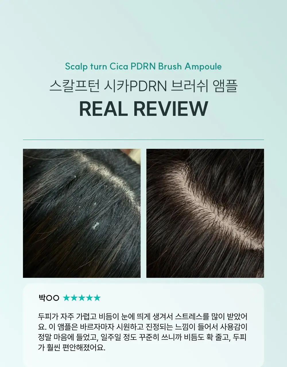 [포켓몬 에디션][비듬/각질케어]릴리이브 스칼프턴 시카 PDRN 브러쉬 앰플 100ml 2종 택1 상세페이지 35